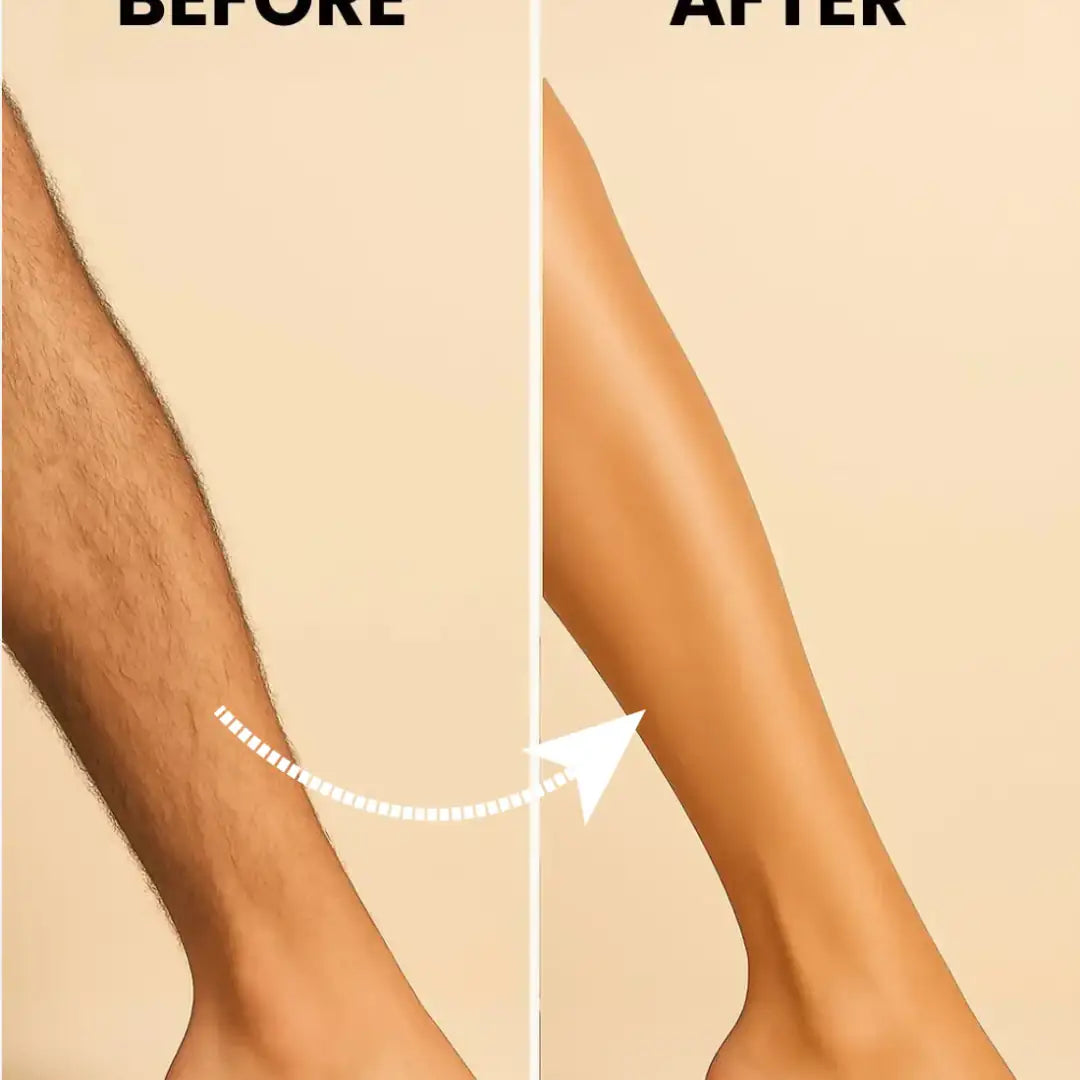 MEEOW 10-Min Painless DIY Hair Removal Mask