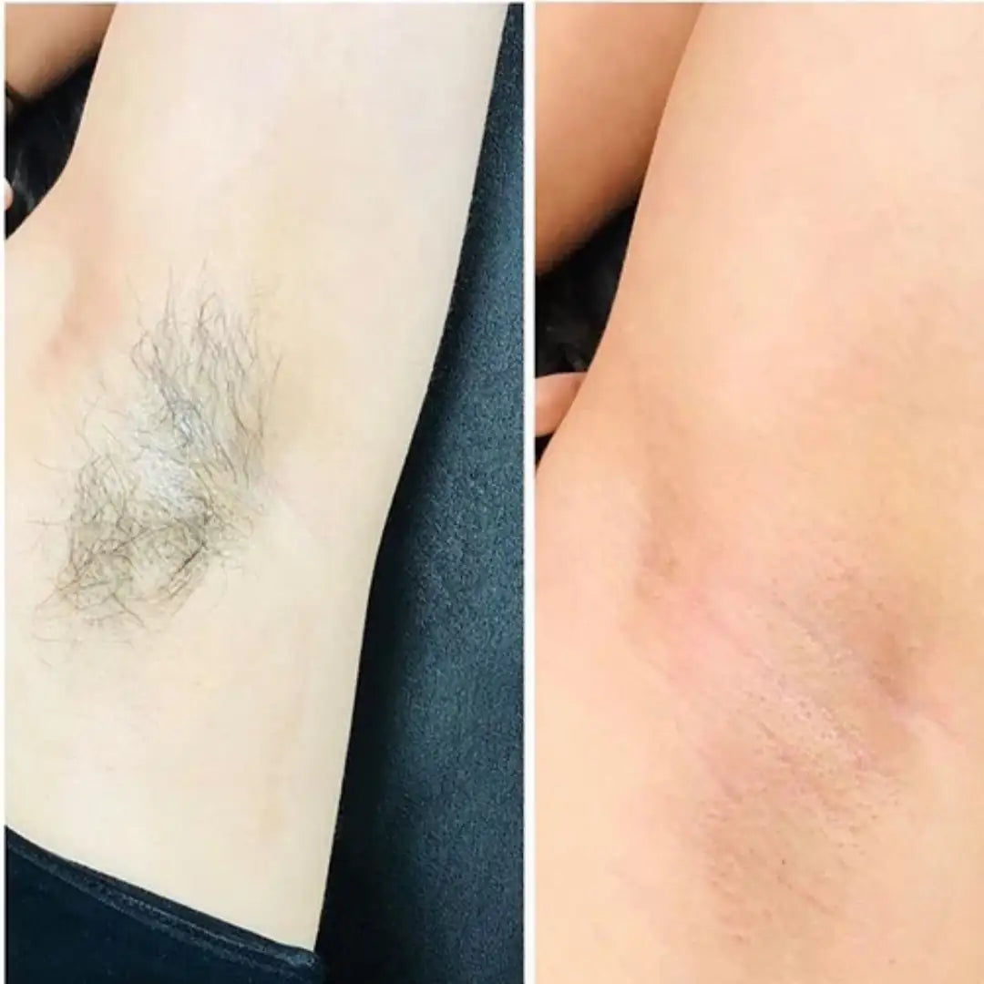 MEEOW 10-Min Painless DIY Hair Removal Mask