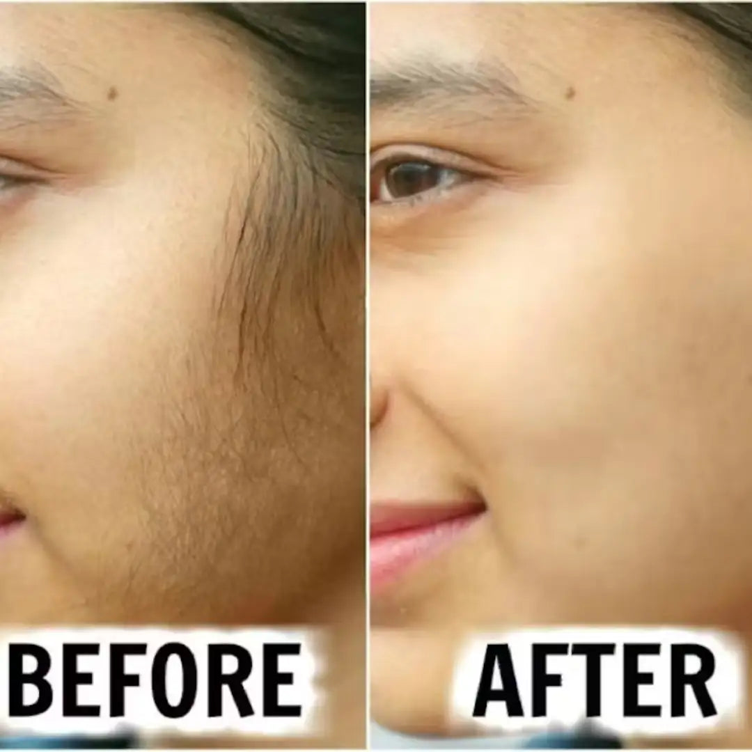 MEEOW 10-Min Painless DIY Hair Removal Mask